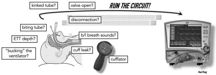 Ventilator low pressure alarm causes