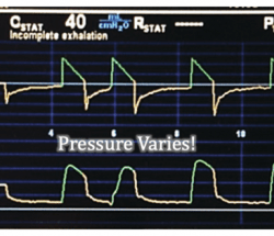 Ventilator checklist nursing alarm ventilation mechanical nurse respiratory alarms high paw care ventilators parameters low vent settings tube airway basics