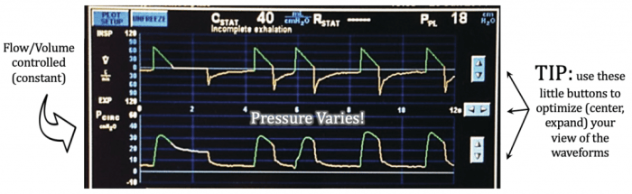 Ventilator checklist nursing alarm ventilation mechanical nurse respiratory alarms high paw care ventilators parameters low vent settings tube airway basics